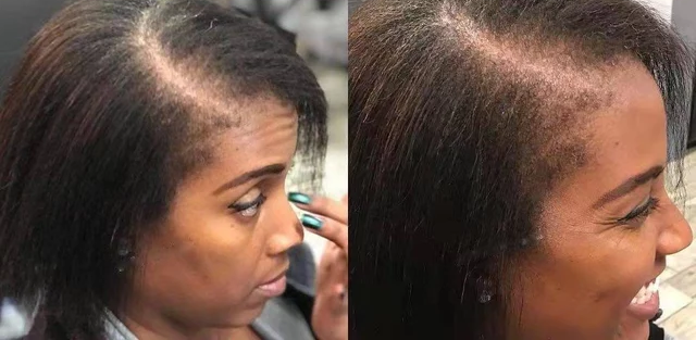 Huile de pousse au chébé