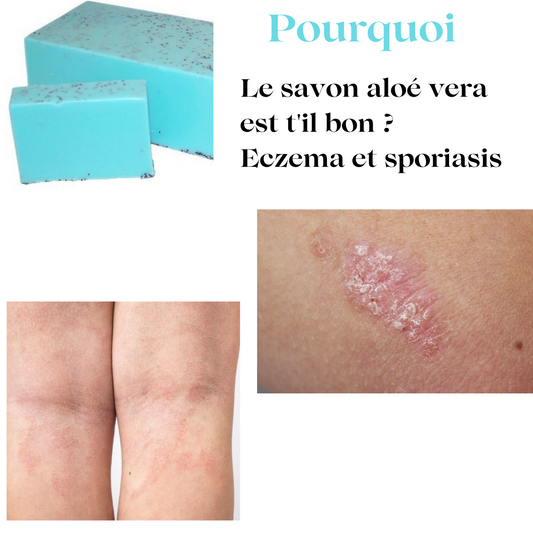 SAVON  SPORIASIS  A ALOE VERA 100G
